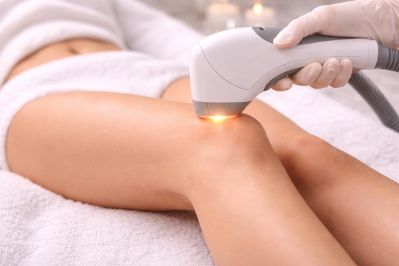 Laser-Haarentfernung