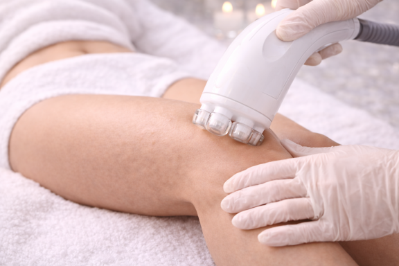 Anti-Cellulite Behandlung Anti-Cellulite Behandlung